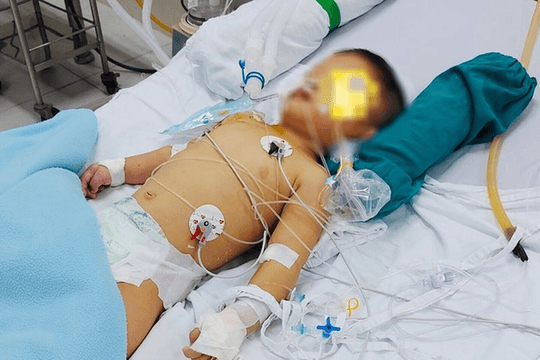 Ngã vào xô nước, bé 14 tháng tuổi tổn thương não nguy kịch