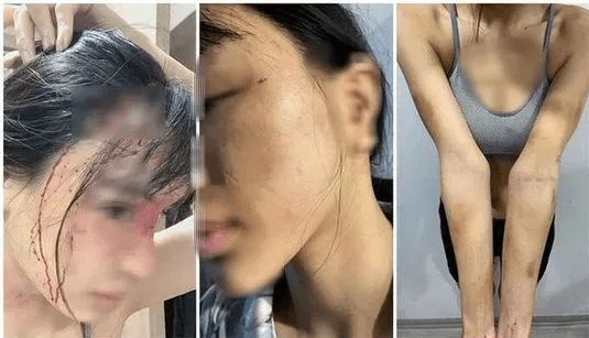 Điều tra vụ siêu mẫu Khả Trang bị chồng sắp cưới bạo hành