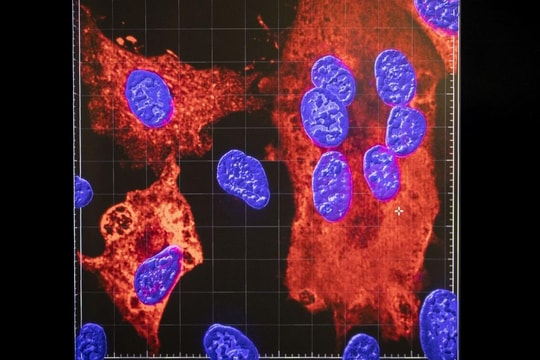 Tin vắn thế giới ngày 6/12: Số ca nhiễm biến thể Omicron ở Mỹ nhiều khả năng sẽ tiếp tục tăng