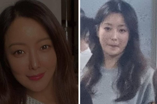 Từng lớn tiếng tuyên bố đẹp ăn đứt cả Kim Tae Hee lẫn Song Hye Kyo, Kim Hee Sun khiến dân mạng băn khoăn vì diện mạo khác lạ