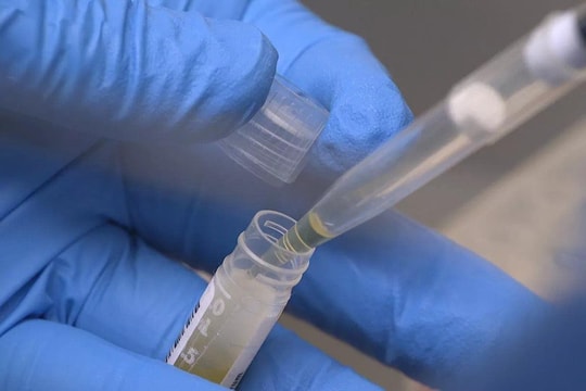 Nga phát triển kít test có khả năng phát hiện ngay biến thể Omicron