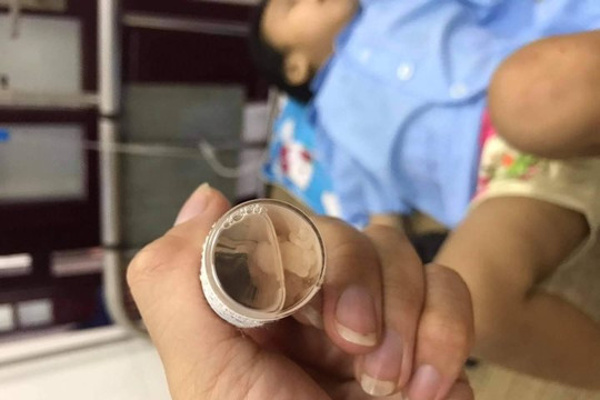 Cháu bé 3 tuổi có đinh trong sọ vẫn rất nguy kịch