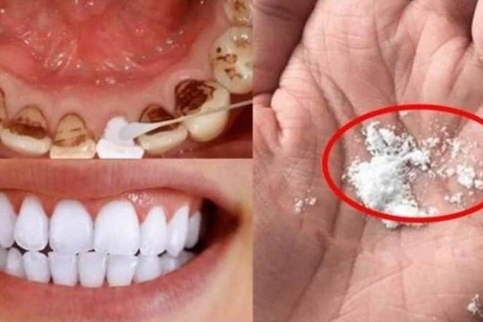 Không rửa răng vàng bằng nước muối! Bỏ 'thứ này' vào nước súc miệng, lau nhẹ, 'trả lại hàm răng trắng bóng', hơi thở thơm tho
