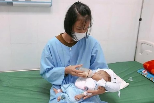 Nuôi sống thành công trẻ sinh non bị viêm ruột hoại tử