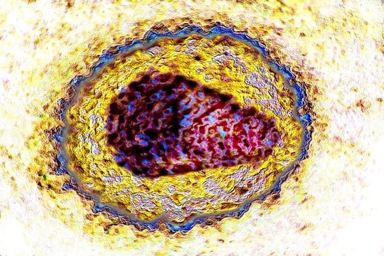 Người phụ nữ đầu tiên trên thế giới đánh bại HIV nhờ tế bào gốc