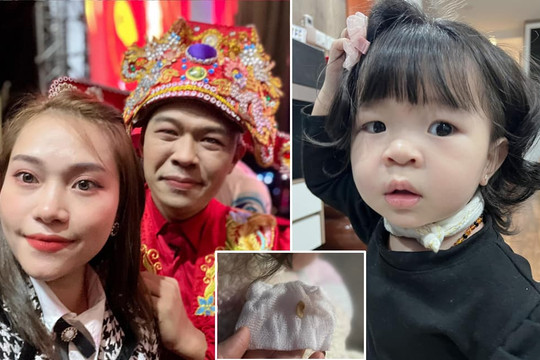Giữa đêm, vợ chồng 'Bắc Đẩu' Trung Ruồi hốt hoảng đưa con gái vào bệnh viện gắp dị vật ở mũi