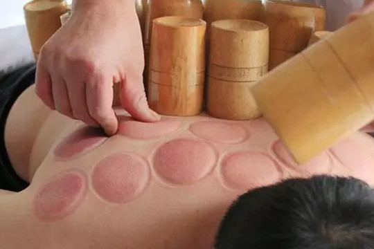 Giác hơi có thể giải độc không? Vết đỏ trên da sau khi giác hơi là gì?