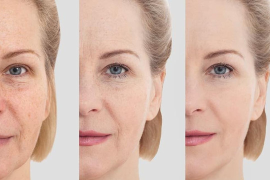 6 yếu tố phá hủy collagen trong da, bảo sao đã làm đủ mọi cách mà da vẫn nhăn nheo, chảy sệ