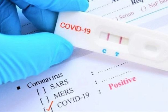 Bộ Y tế yêu cầu niêm yết giá bộ xét nghiệm SARS-CoV-2
