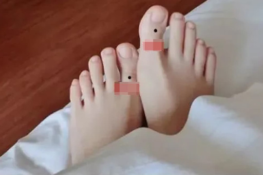 Người phụ nữ có dáng bàn chân như thế này sinh ra đã giàu có!
