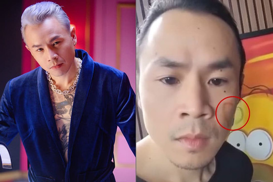 Binz khiến dân tình 'tá hỏa' vì màn 'đú trend' có một không hai, vào kênh chính chủ mà cứ ngỡ tài khoản mạo danh