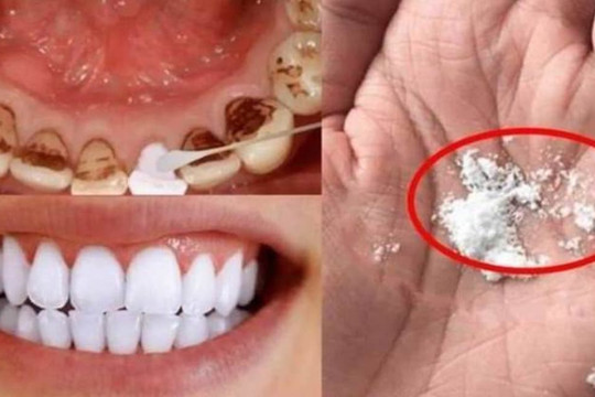 Không rửa răng vàng bằng nước muối! Bỏ thứ gì đó vào nước súc miệng, lau nhẹ, 'trả lại hàm răng trắng bóng', hơi thở thơm mát hơn