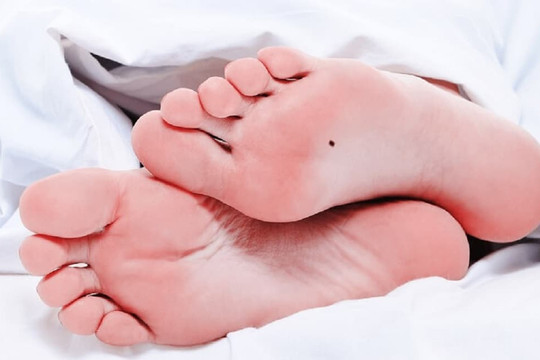 Những vị trí nốt ruồi ở bàn chân đem lại may mắn, tài lộc phú quý, tiền tài và danh vọng đều có đủ, hậu vận viên mãn