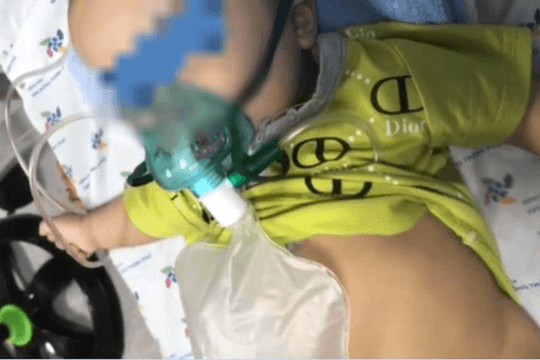 Bé 5 tháng bị viêm thanh quản hiếm gặp do Covid-19