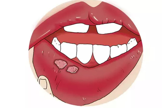 3 bộ phận trên cơ thể ngày càng to ra, một chỗ bốc mùi hôi có thể là dấu hiệu của bệnh ung thư, cần đi kiểm tra sớm