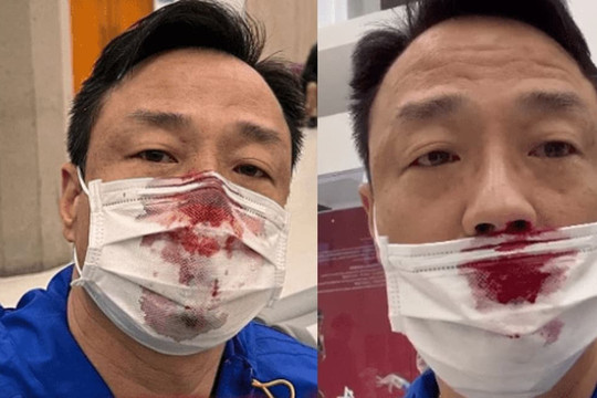 Sao Hong Kong 54 tuổi chảy máu mũi đầm đìa vì bị chọc dụng cụ quá mạnh khi đi test Covid-19