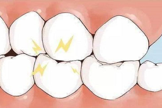 Bệnh gan, tiên tri răng? Nếu có 2 loại bất thường trên răng, có thể gan đang “kêu cứu”