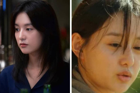 Nữ thần 'Hậu duệ của mặt trời' Kim Ji Won biến đổi nhan sắc: Mặt bỗng béo mũm, da dẻ nhợt nhạt