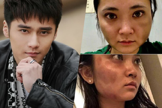 Mỹ nam phim 'Bộ Bộ Kinh Tâm' làm shipper mưu sinh sau bê bối bạo hành bạn gái phải rời showbiz