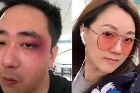 Sao nam đầu tiên trong Cbiz tố bị bạo hành gia đình, 6 lần vợ dí tàn thuốc vào người, bị tát 500 cái vào mặt