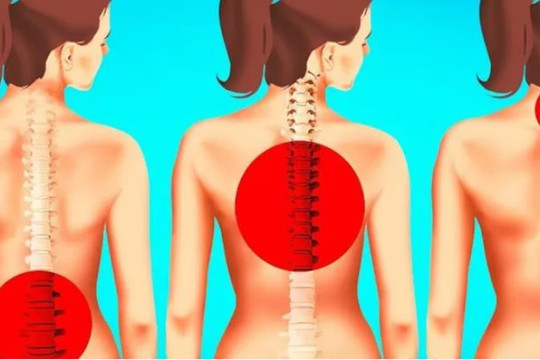 Các bài tập kéo giãn cơ trong một phút giúp bạn giảm đau lưng ngay lập tức