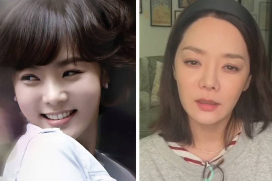 Không nhận ra 'Nữ thần thanh xuân' Chae Rim: Hai cuộc hôn nhân tan vỡ và phẫu thuật thẩm mỹ phá nát hình ảnh 'ngọc nữ'