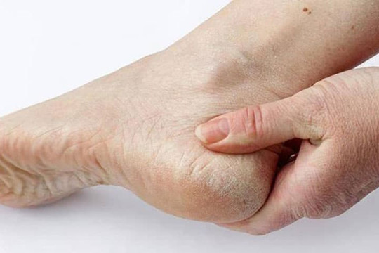 Gan có tốt hay không là do bàn chân 'biết trước', nếu bàn chân gửi 4 'tín hiệu' này, đừng bất cẩn