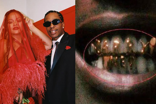 Cầu hôn kiểu bạn trai Rihanna: Gắn dòng chữ 'Cưới anh nhé' lên răng, cách cô nàng đáp trả cũng 'độc' không kém