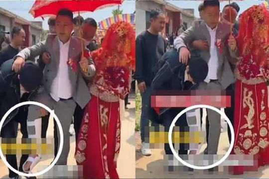Chú rể gãy chân trong ngày cưới vì bị bạn trêu quá đà