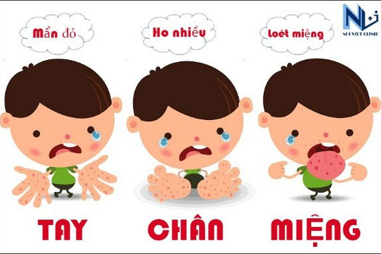 Không để dịch bệnh tay chân miệng bùng phát, lan rộng và kéo dài