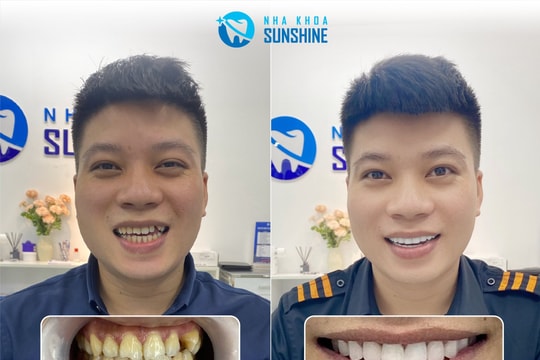 Không dao kéo vẫn khiến nhan sắc lên hương, điều mà đa số sao Việt lựa chọn