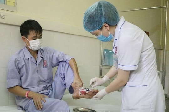 Hoại tử bàn chân do chữa bỏng bằng lông gà và thuốc 'lạ'