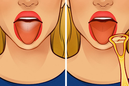 Đừng quên cạo lưỡi vào buổi sáng và những thói quen tốt cho cơ thể bạn nên biết