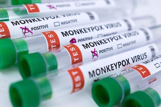 Tin vắn thế giới ngày 15/6: EU ký kết hợp đồng mua khoảng 110.000 liều vaccine phòng đậu mùa khỉ