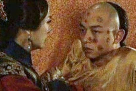 Cách đây 41 năm, bệnh đậu mùa đã được loài người loại trừ, căn bệnh giết chết hàng trăm triệu người này đã bị xóa sổ như thế nào?