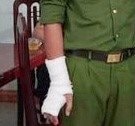 Thượng úy công an bị thương khi vây bắt đối tượng mua bán ma túy 