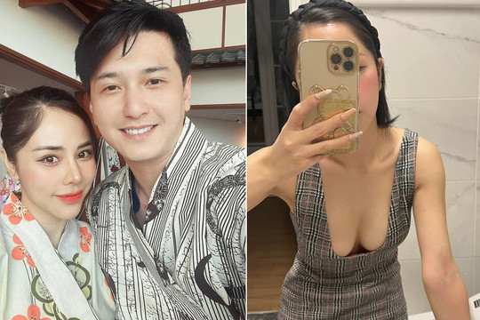 Bạch Lan Phương 'kể khổ' khi yêu Huỳnh Anh: 'Bạn trai em không cho mặc như này ra đường'
