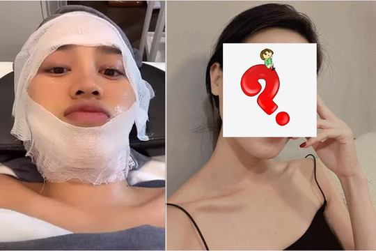 Sao Việt 10/7: Đỗ Thị Hà băng bó khắp mặt, netizen nghi dao kéo. Nhan sắc Hoa hậu Thùy Dung trông thế nào sau nhiều năm ở ẩn?