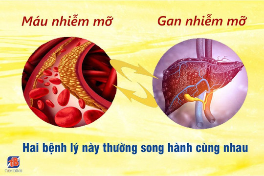 Mỡ máu cao, gan nhiễm mỡ, điều trị như thế nào?
