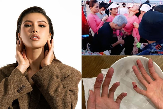 Minh Tú thương tích đầy người khi làm huấn luyện viên Hoa hậu Thể thao Việt Nam, nhìn đôi bàn tay mà xót xa