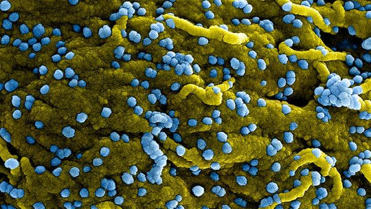 WHO cảnh báo loại virus gây tử vong đến 90%