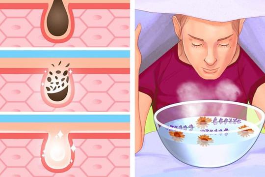Lợi ích của việc xông hơi mặt và cách thực hiện