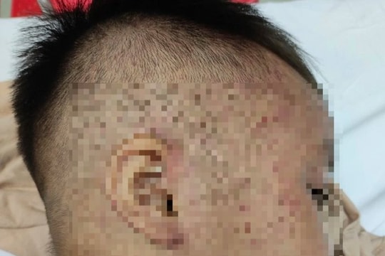 Sức khỏe của bé trai 3 tuổi nghi bị cho vào tủ cấp đông