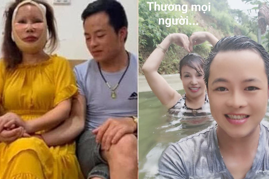 'Cô dâu 62 tuổi' hiện tại trông thế nào sau biến chứng thẩm mỹ khiến mặt biến dạng?
