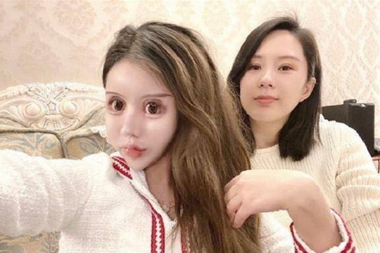 Cô gái chi bộn tiền và phẫu thuật thẩm mỹ hơn 60 lần trong 3 năm nay đã trở thành 'búp bê Barbie' nhưng ai nhìn cũng sợ
