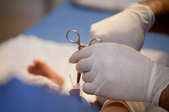 Cắt bao quy đầu ở một cơ sở xăm hình, “của quý” bị chảy máu liên tục