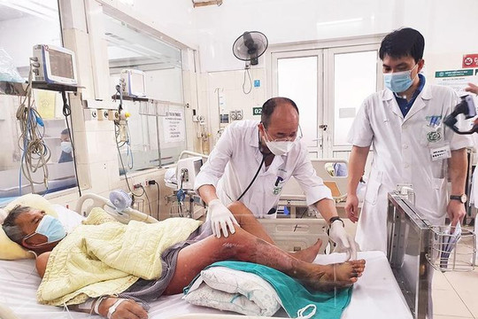 Hoại tử chân, sốc nhiễm khuẩn nặng do vi khuẩn Vibrio vulnificus