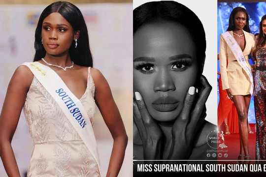 Miss Supranational South Sudan - Amelia Sky qua đời, fans sắc đẹp không khỏi xót xa