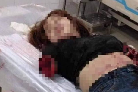 “Người thứ ba” trong vụ chồng chém lìa 2 cánh tay vợ có phạm pháp?