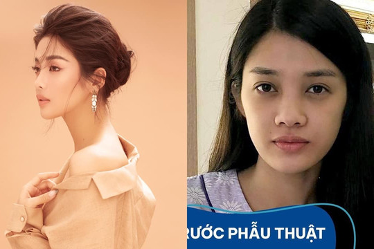 Sau 2 năm giấu kín, 'Nàng Kiều' Trình Mỹ Duyên lần đầu tiết lộ gương mặt có can thiệp thẩm mỹ